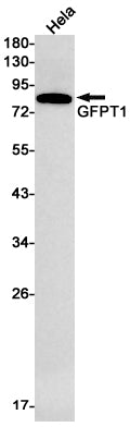 GFPT1 Rabbit Monoclonal Antibody