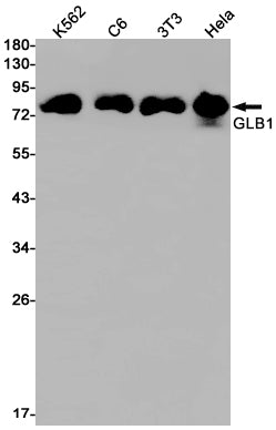GLB1 Rabbit Monoclonal Antibody
