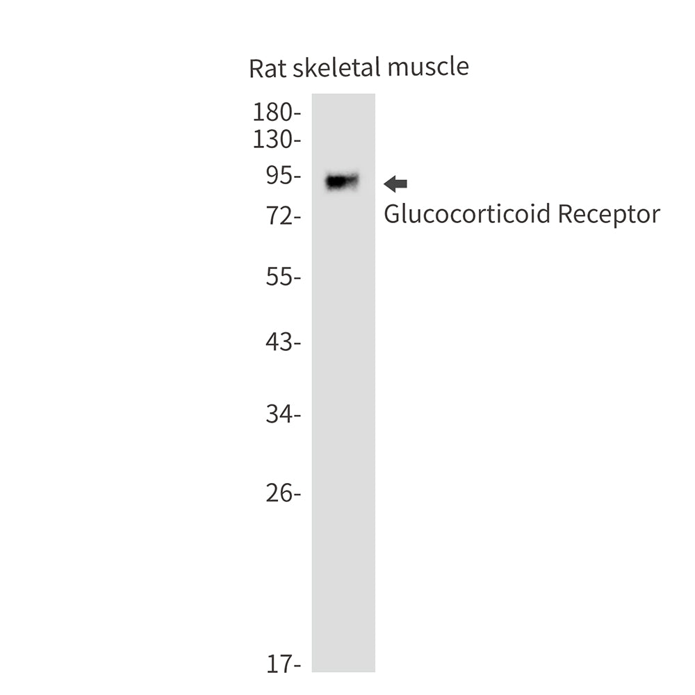 Glucocorticoid Receptor Rabbit Monoclonal Antibody
