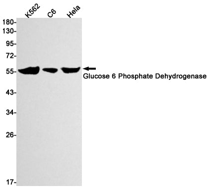 Glucose 6 Phosphate Dehydrogenase Rabbit Monoclonal Antibody