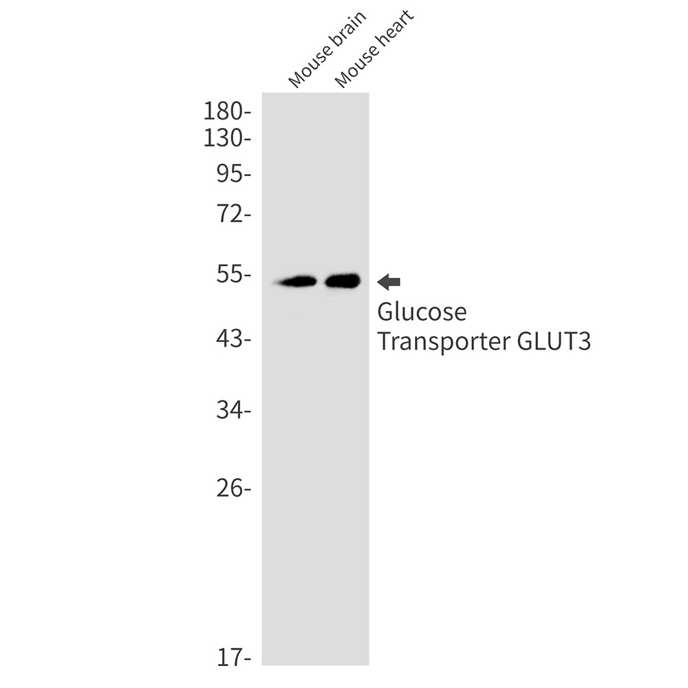 Glucose Transporter GLUT3 Rabbit Monoclonal Antibody