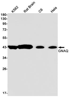 GNAQ Rabbit Monoclonal Antibody