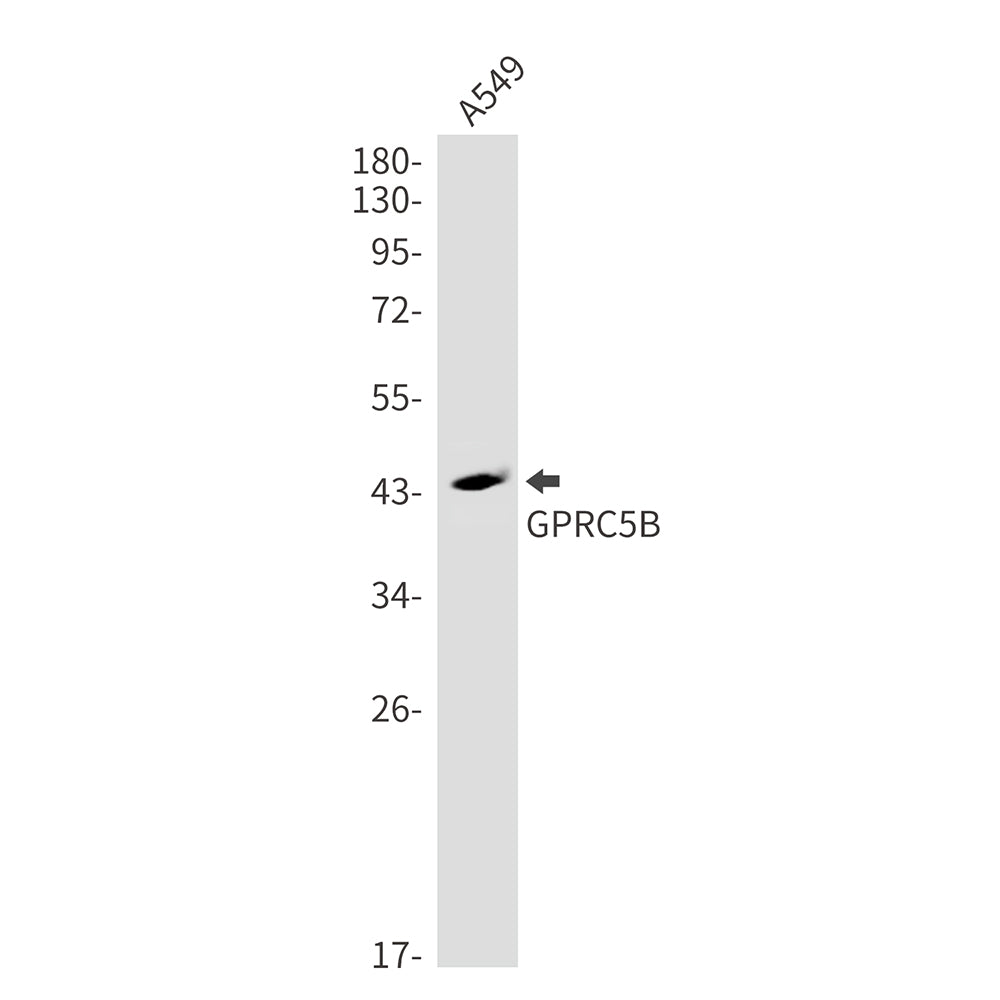 GPRC5B Rabbit Monoclonal Antibody