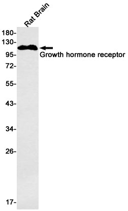 Growth Hormone Receptor Rabbit Monoclonal Antibody