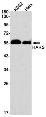 HARS Rabbit Monoclonal Antibody