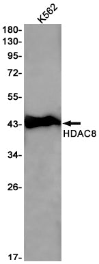 HDAC8 Rabbit Monoclonal Antibody