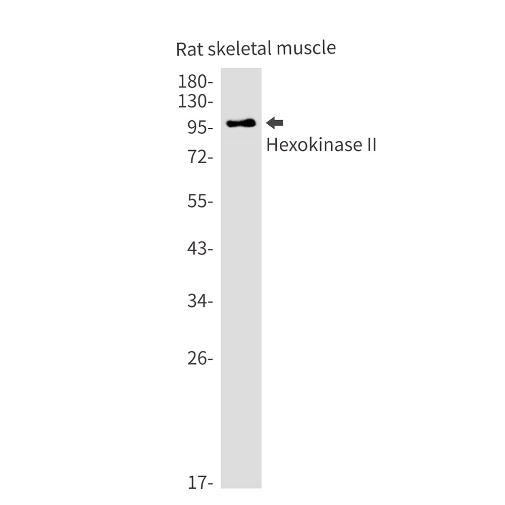 Hexokinase II Rabbit Monoclonal Antibody