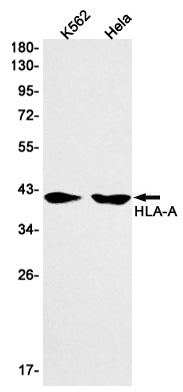 HLA A Rabbit Monoclonal Antibody