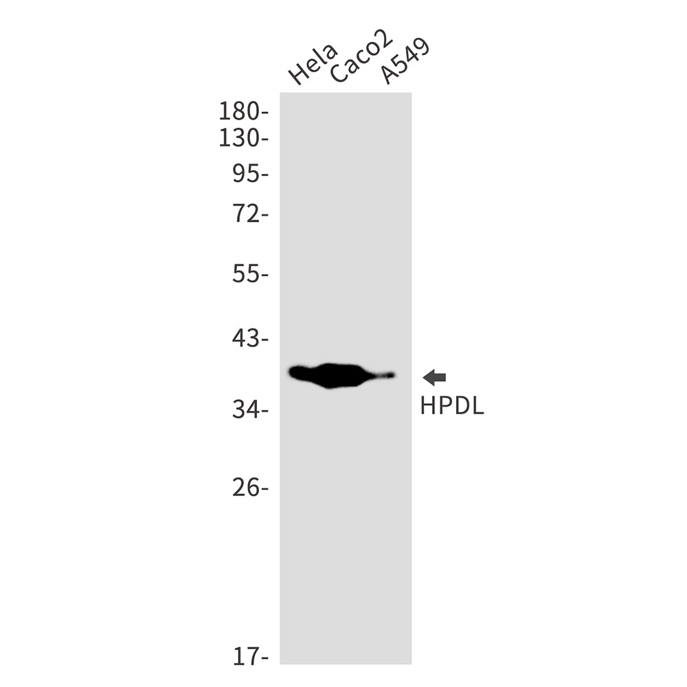 HPDL Rabbit Monoclonal Antibody