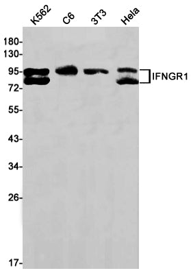 Interferon gamma Receptor 1 Rabbit Monoclonal Antibody