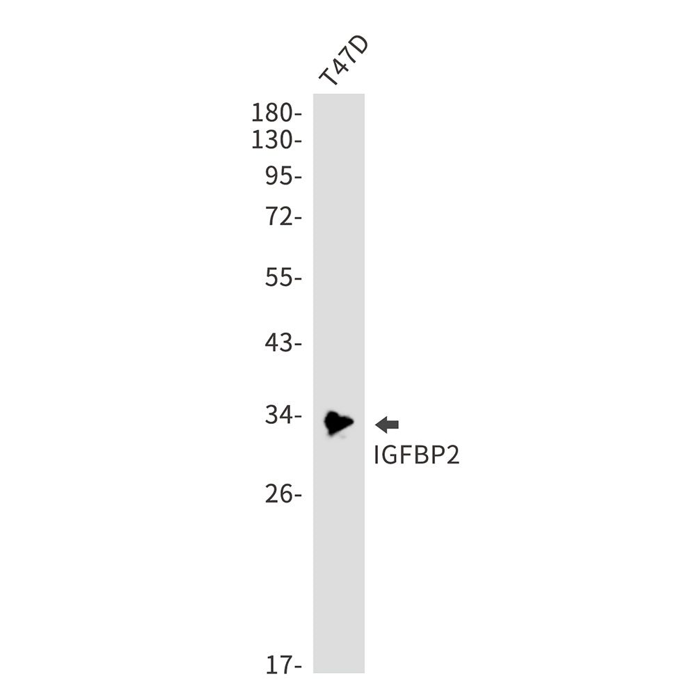 IGFBP2 Rabbit Monoclonal Antibody