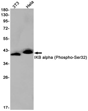 Phospho-IKB alpha (Ser32) Rabbit Monoclonal Antibody