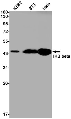 IKB beta Rabbit Monoclonal Antibody