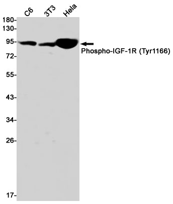 Phospho-IGF1 Receptor (Tyr1166) Rabbit Monoclonal Antibody