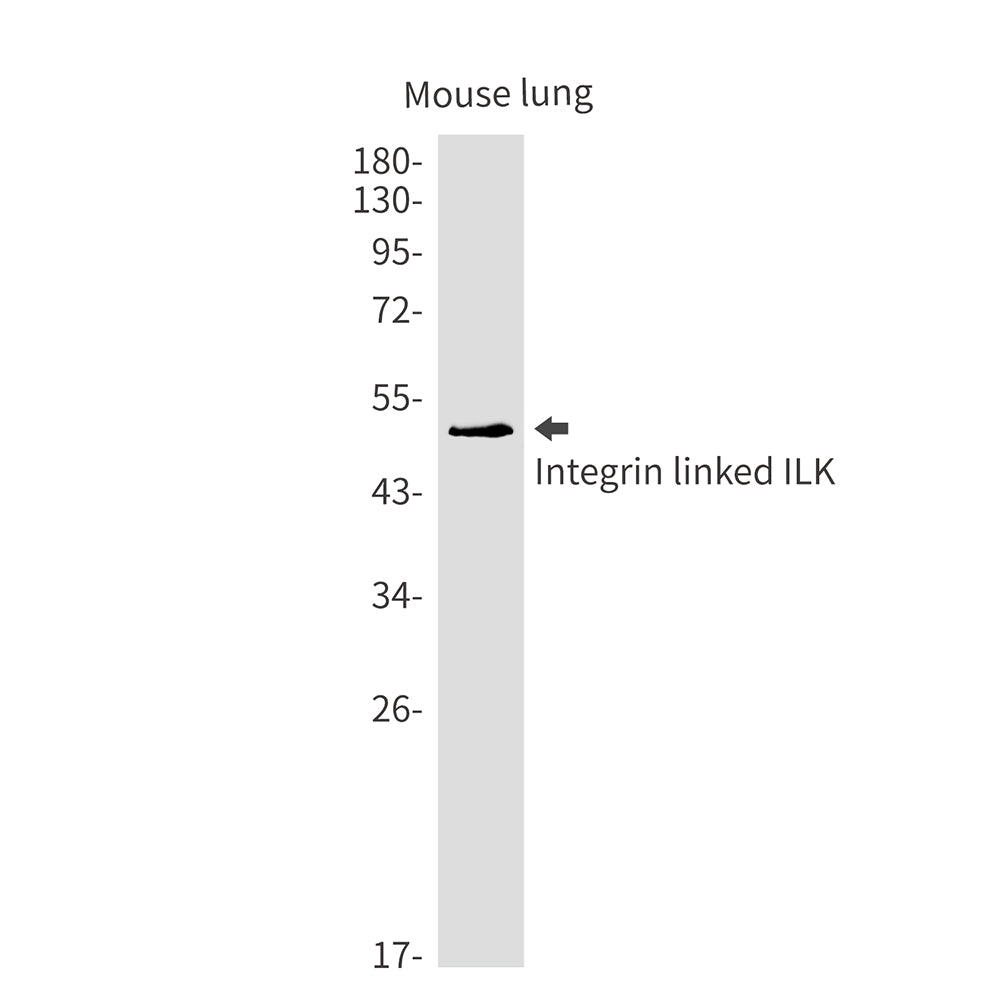 Integrin Linked ILK Rabbit Monoclonal Antibody