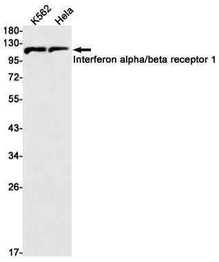Interferon alpha/beta Receptor 1 Rabbit Monoclonal Antibody