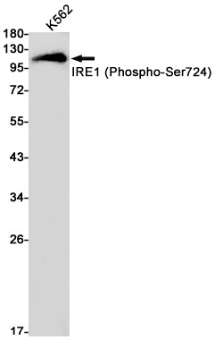 Phospho-IRE1 (Ser724) Rabbit Monoclonal Antibody