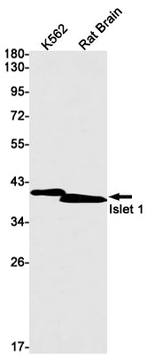 Islet 1 Rabbit Monoclonal Antibody
