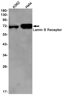 Lamin B Receptor Rabbit Monoclonal Antibody