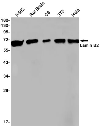 Lamin B2 Rabbit Monoclonal Antibody