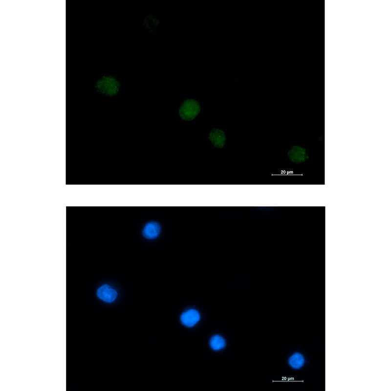 LGALS14 Rabbit Monoclonal Antibody