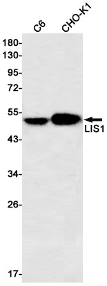 LIS1 Rabbit Monoclonal Antibody