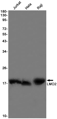 LMO2 Rabbit Monoclonal Antibody