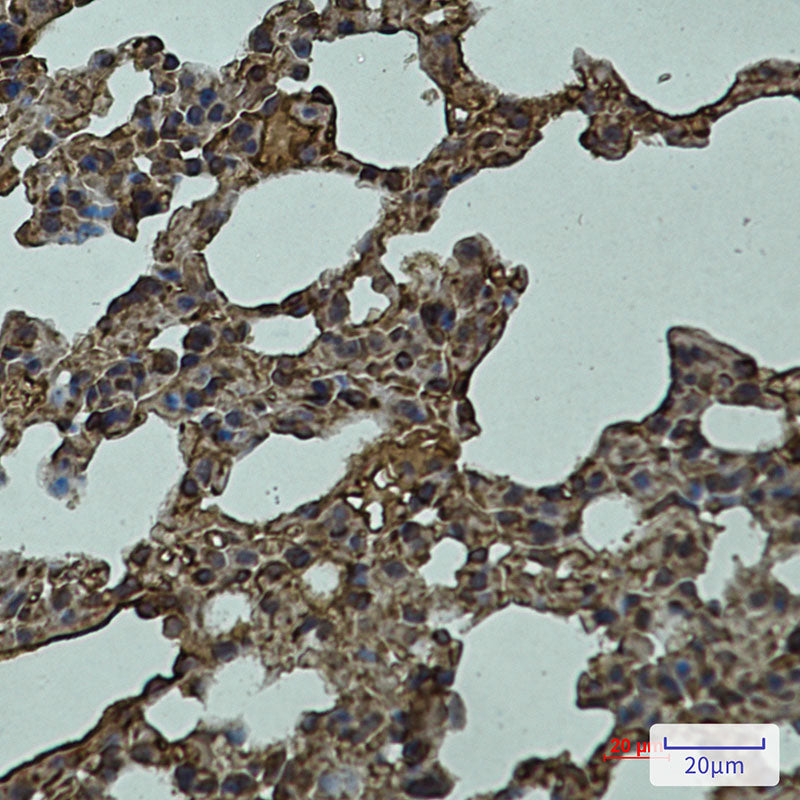 LYVE1 Rabbit Monoclonal Antibody