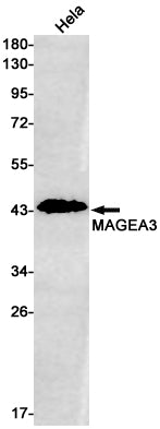 MAGEA3 Rabbit Monoclonal Antibody