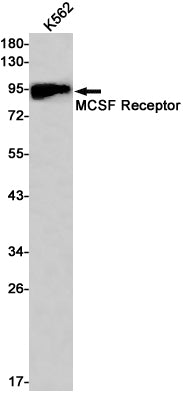 M-CSF Receptor Rabbit Monoclonal Antibody