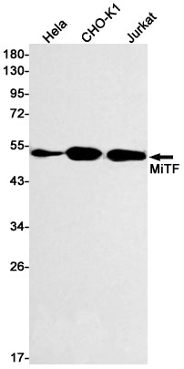 MiTF Rabbit Monoclonal Antibody