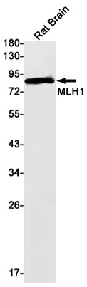 MLH1 Rabbit Monoclonal Antibody