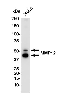 MMP12 Rabbit Monoclonal Antibody