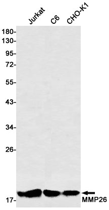 MMP26 Rabbit Monoclonal Antibody