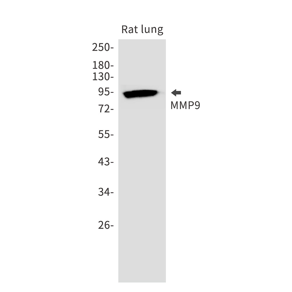 MMP9 Rabbit Monoclonal Antibody