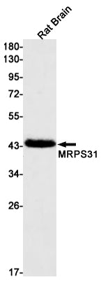 MRPS31 Rabbit Monoclonal Antibody