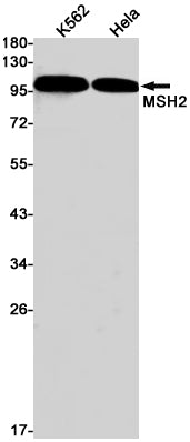 MSH2 Rabbit Monoclonal Antibody