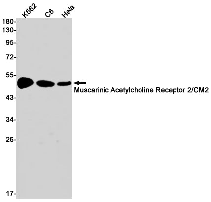 Muscarinic Acetylcholine Receptor M2 Rabbit Monoclonal Antibody