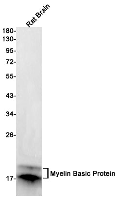 Myelin Basic Protein Rabbit Monoclonal Antibody