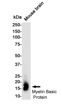 Myelin Basic Protein Rabbit Monoclonal Antibody