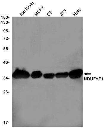 NDUFAF1 Rabbit Monoclonal Antibody