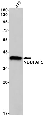 NDUFAF5 Rabbit Monoclonal Antibody