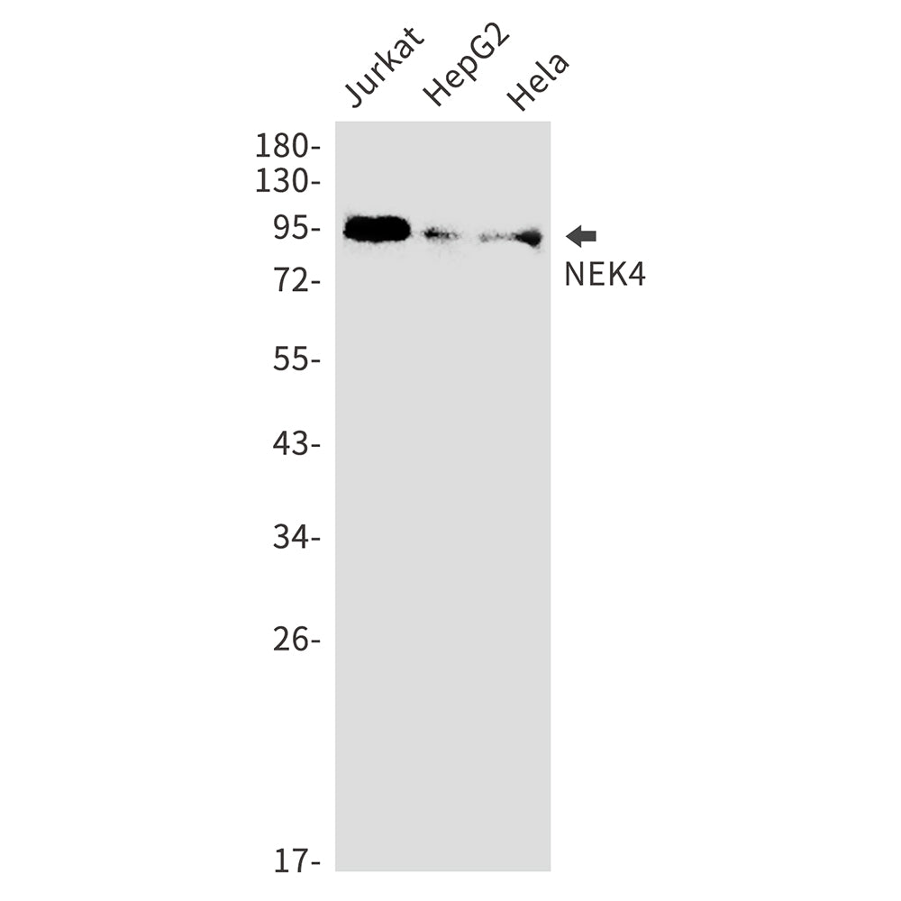 NEK4 Rabbit Monoclonal Antibody