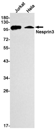 Nesprin3 Rabbit Monoclonal Antibody