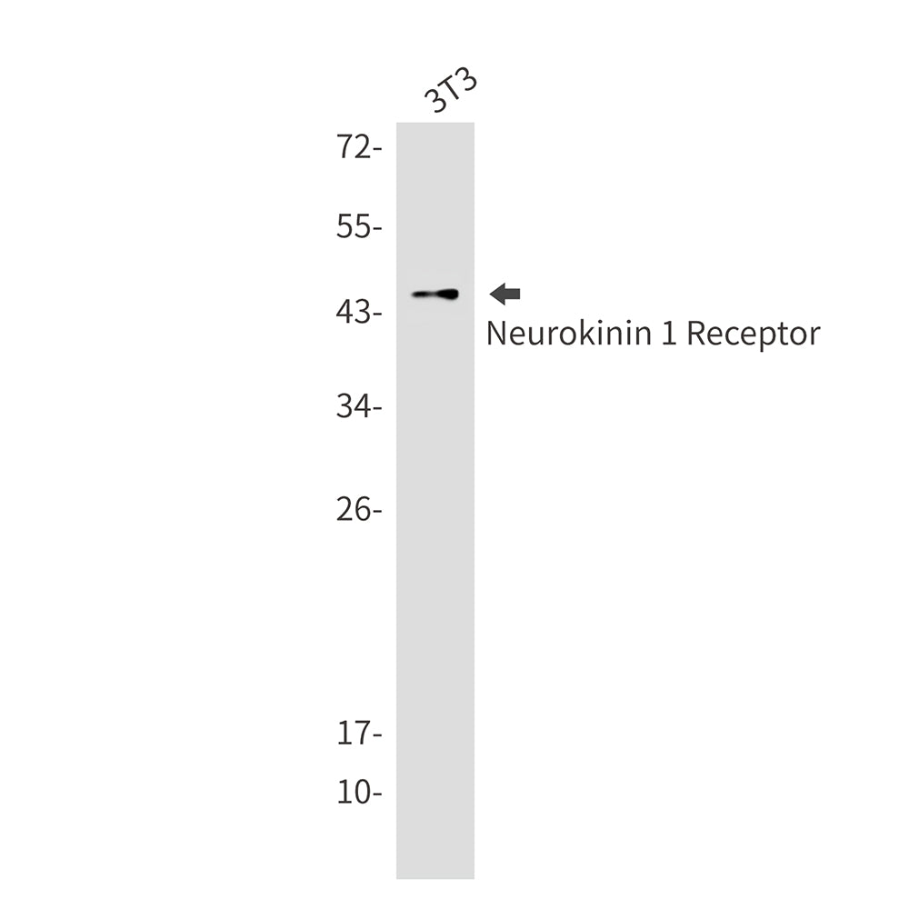 Neurokinin 1 Receptor Rabbit Monoclonal Antibody