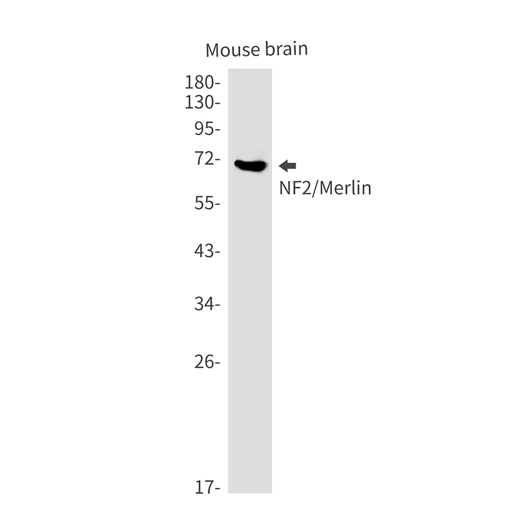 NF2 Rabbit Monoclonal Antibody