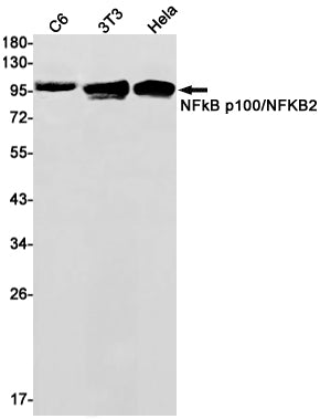 NF-KB p100 Rabbit Monoclonal Antibody