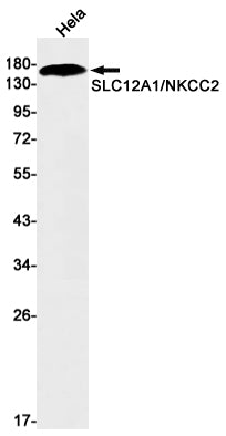 SLC12A1 Rabbit Monoclonal Antibody
