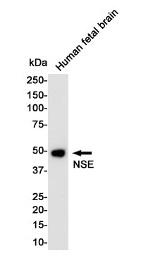 NSE Rabbit Monoclonal Antibody