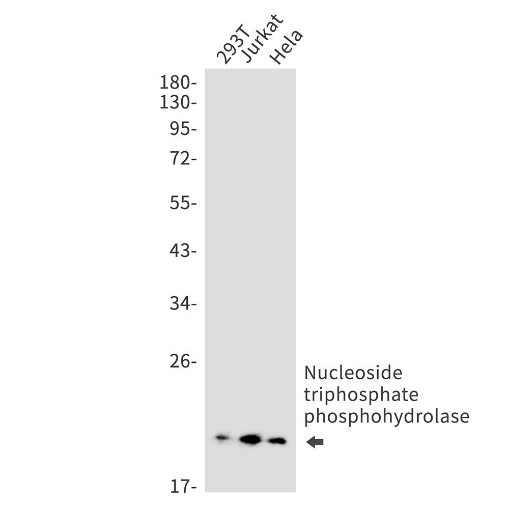 NTPCR Rabbit Monoclonal Antibody